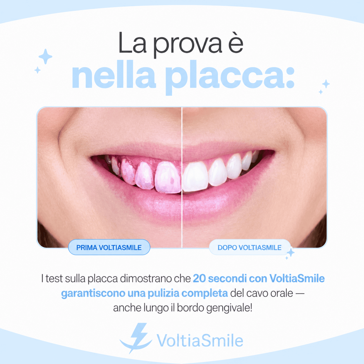 VoltiaSmile - Lavarsi i denti accuratamente in meno di 20 secondi