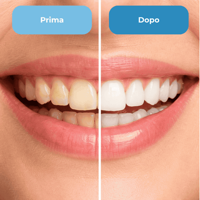 Risultati VoltiaSmile